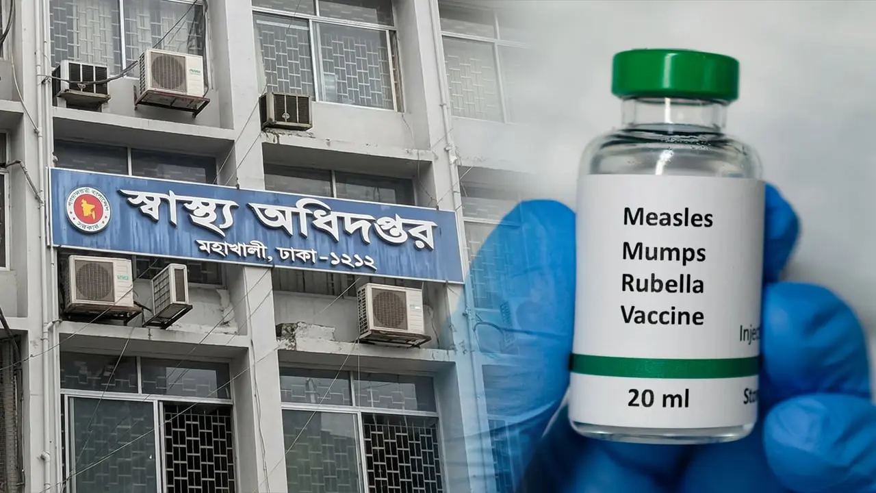 হাম ভয়াবহ রূপে, দেড় মাসে প্রাণ গেল ৪৩২ শিশুর